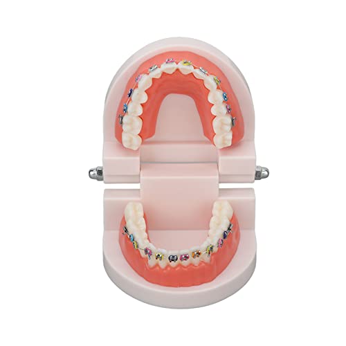 Orthodontic Dental Model, Typodonts Orthodontic Demonstration Model with Metal Wires and Bracket Teaching, Learning, Interpretation Model for Adults and Children