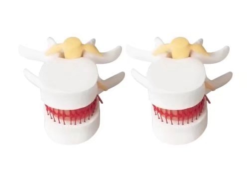 BoNew 1:1.5 Anatomical Human Lumbar Vertebrae Degenerative Lumbar Human Spine Model White Color