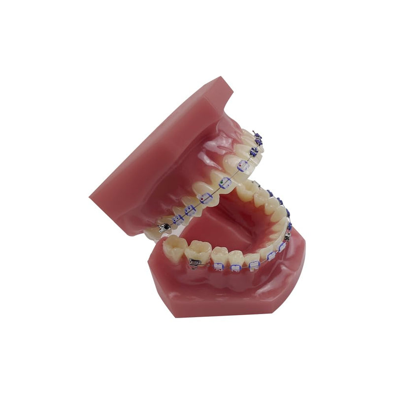 Orthodontic Tooth Model with Brackets, YOUYA DENTAL Demonstration Orthodontic Model for Education, Teeth Demonstration Typodonte Anatomical Teaching Tool with Metal and Ceramic Holder