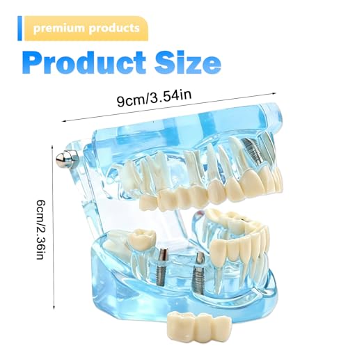 Dental Model with Removable Teeth, Dental Model, Transparent Model for Diseased Teeth, Transparent Tooth Model for Education, Clinic and Patient Demonstration, Blue