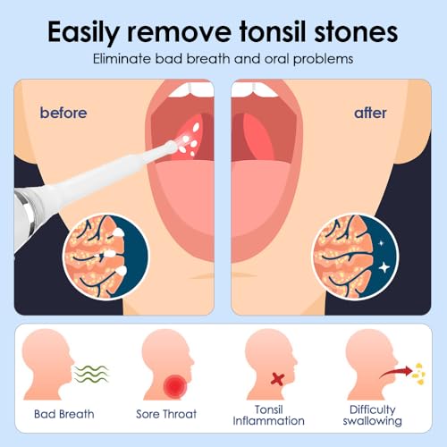 Tonsil Stone Remover Set, 65 kpa Electric Almond Stones Removal | 3-speed suction, with LED light and 5x magnifying glass, for healthy almonds and fresh breath White