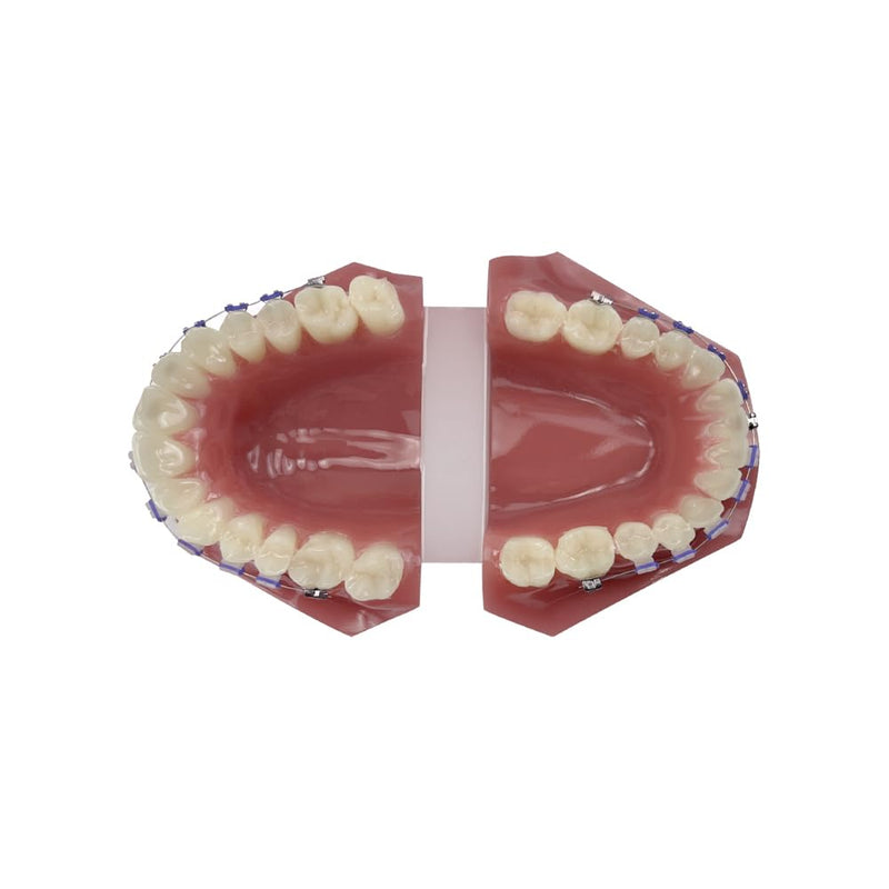 Orthodontic Tooth Model with Brackets, YOUYA DENTAL Demonstration Orthodontic Model for Education, Teeth Demonstration Typodonte Anatomical Teaching Tool with Metal and Ceramic Holder