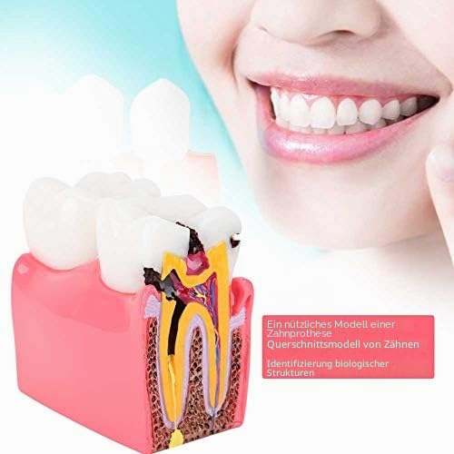 Dental Anatomy Model Resin Dental Lab Oral Care Model