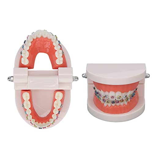 Orthodontic Dental Model, Typodonts Orthodontic Demonstration Model with Metal Wires and Bracket Teaching, Learning, Interpretation Model for Adults and Children