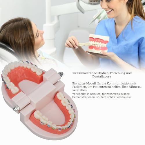 Orthodontic Dental Model, Typodonts Orthodontic Demonstration Model with Metal Wires and Bracket Teaching, Learning, Interpretation Model for Adults and Children