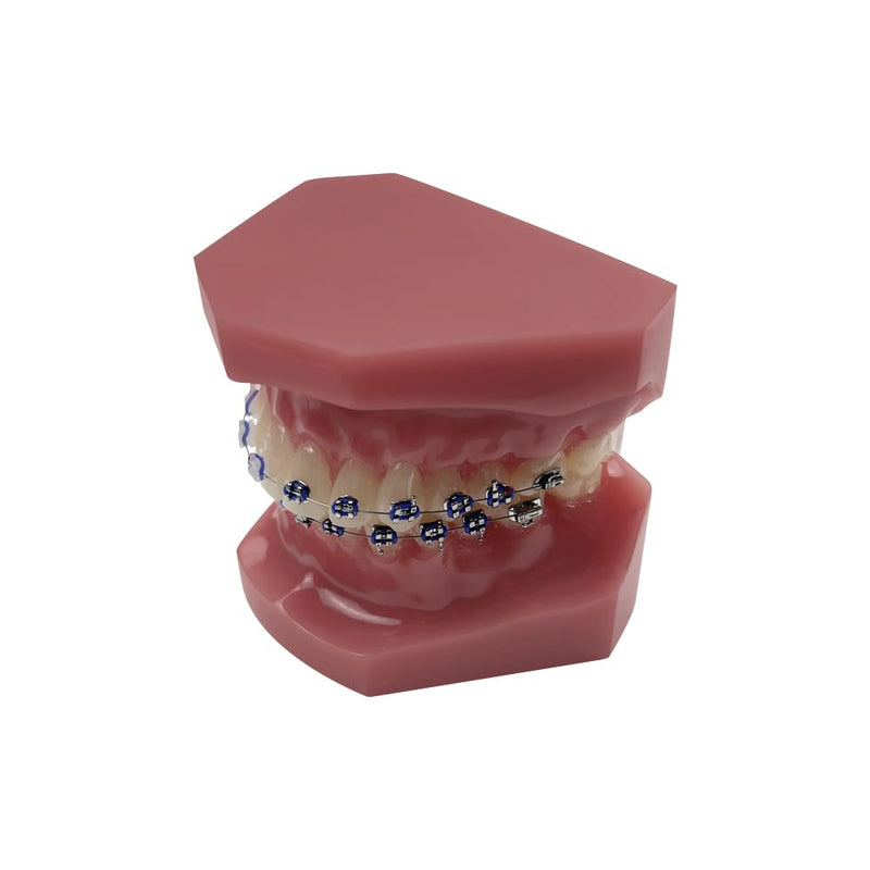 Orthodontic Tooth Model with Brackets, YOUYA DENTAL Demonstration Orthodontic Model for Education, Teeth Demonstration Typodonte Anatomical Teaching Tool with Metal and Ceramic Holder