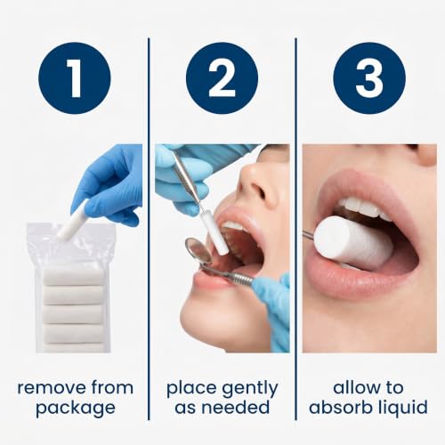Pack of 300 Nasal Tamponade, 3.8 x 1 cm Nosebleed Stopper, Nampons Against Nosebleeds, Percent Highly Absorbent Cotton Rolls, Soft Gauze Rolls for Emergency or Accident (B)