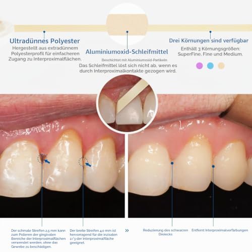 Tooth Sandpaper, Dental Polishing Strips, Ultra Fine Size - 4 mm Width - 6 m / Rolls/Box, NatureAqua Resin Tooth Polishing Interdental Sanding Tool Yellow-4 Mm Width