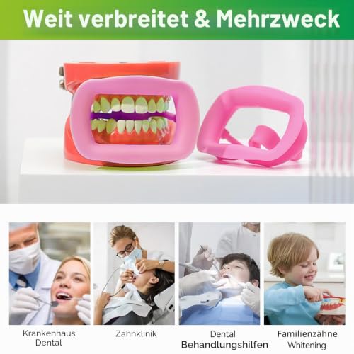 2 Pieces Dental Mouth Openers Reusable Autoclavable Silicone Teeth Whitening Cheek Holder Lip Holder for Dentist Mouth Inspection Mouth Guard Challenge Game (Pink) Pink