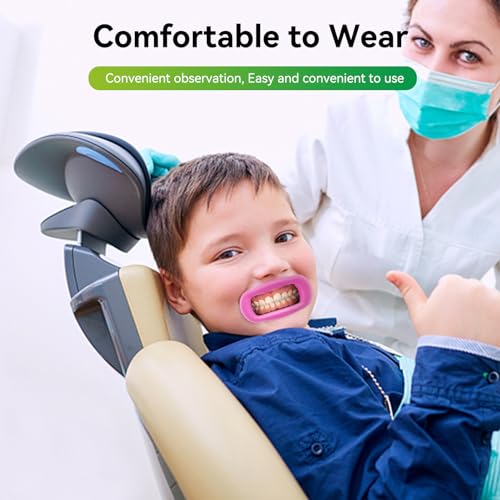 2 Pieces Dental Mouth Openers Reusable Autoclavable Silicone Teeth Whitening Cheek Holder Lip Holder for Dentist Mouth Inspection Mouth Guard Challenge Game (Pink) Pink