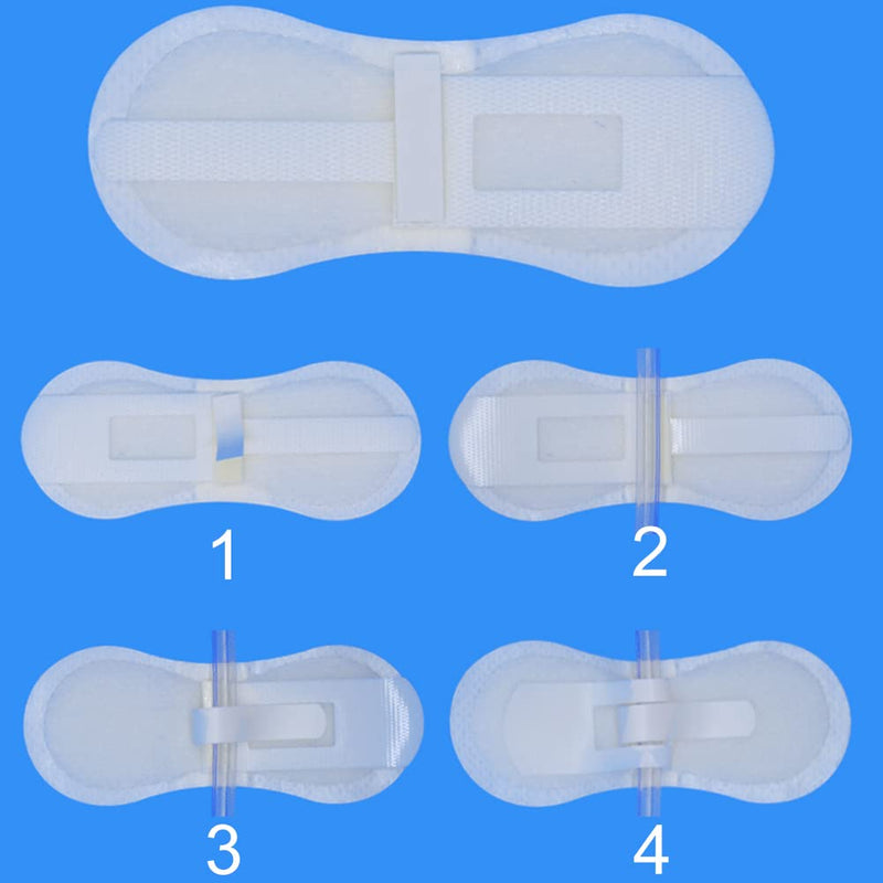 Low-Profile Catheter Stabilization Device for Kids Baby's Gtube Feeding Tube G J Tube Peg Pd Catheter Holder Peritoneal Dialysis Accessories Adhesive Patch Dressing (Pack of 20) Low Profile Tube Holder - 20 Pcs
