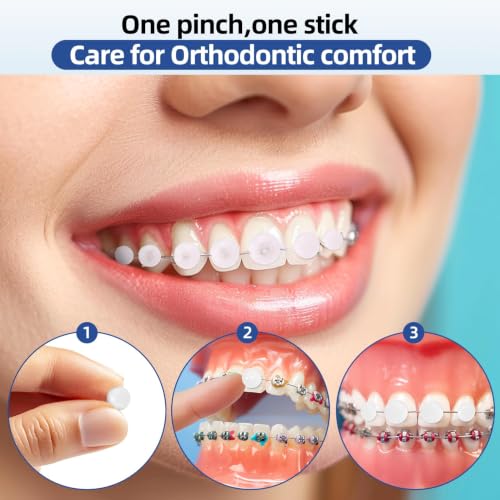 Orthodontic Wax Dots for Braces, 60 Count Single Pack, Braces Wax, Pre-Cut Dental Wax for Pain Relief, Food-Grade Microcrystalline Wax, Mint Flavor