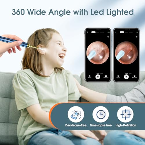 TOUCHBeauty Ear Wax Remover Otoscope, 1080P HD WiFi Ear Cleaner with Camera and 6 LEDs, IP67 Waterproof Ear Camera, USB Rechargeable for iPhone, iPad, Android, Children & Pets