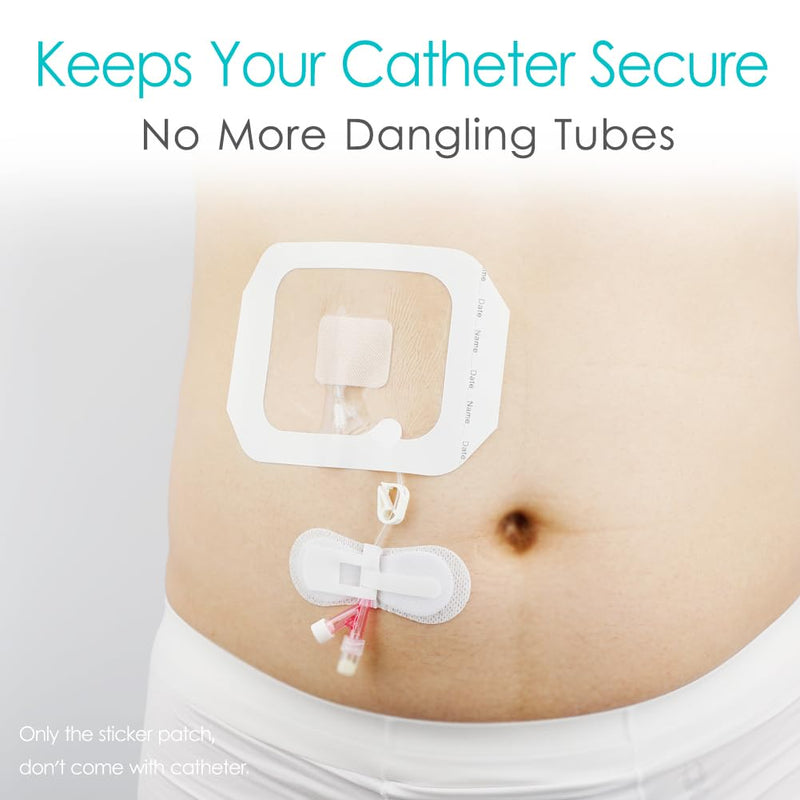 Low-Profile Catheter Stabilization Device for Kids Baby's Gtube Feeding Tube G J Tube Peg Pd Catheter Holder Peritoneal Dialysis Accessories Adhesive Patch Dressing (Pack of 20) Low Profile Tube Holder - 20 Pcs