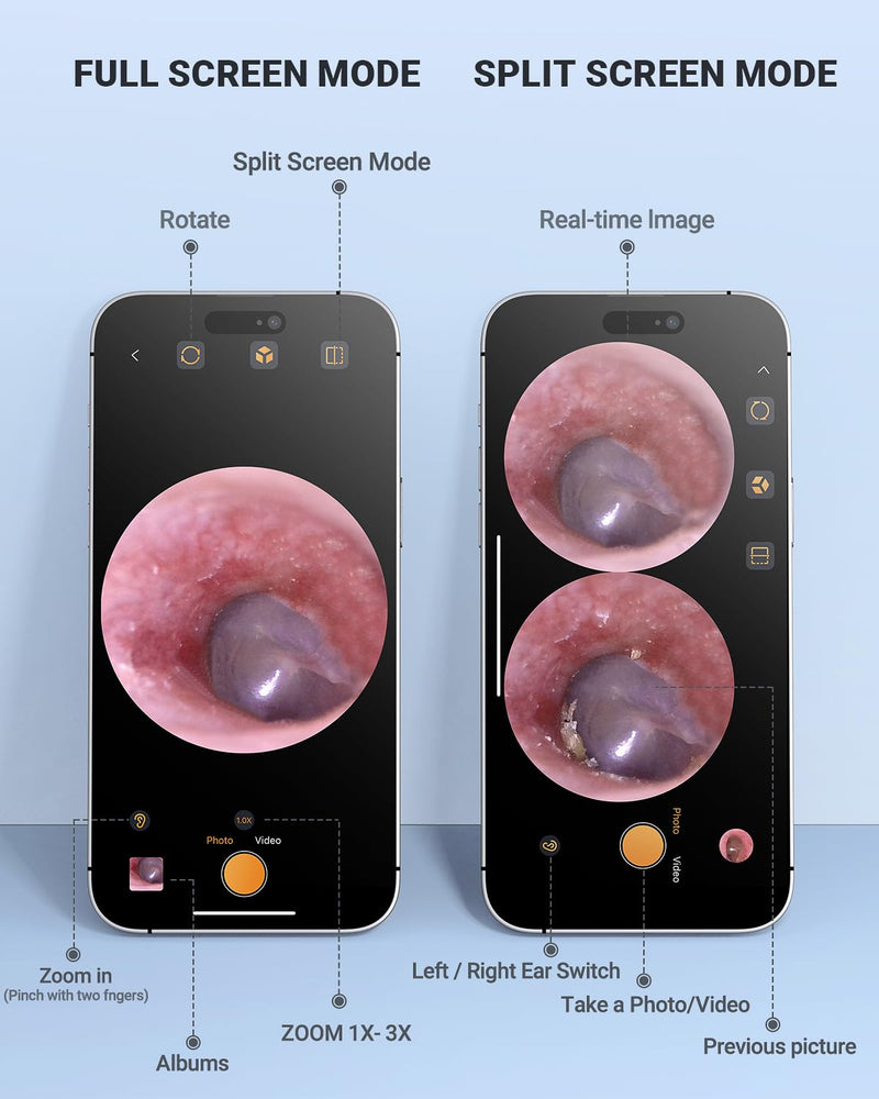HD Digital Otoscope, Video Ear Scope Otoscope with Light, Ultra Clear View Ear Camera with Ear Wax Removal Tools, Compatible with iPhone and Android Devices (Purple) ﻿ Purple