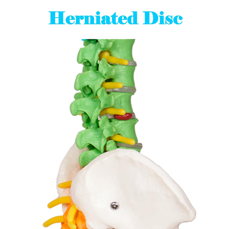 breesky Scientific Mini Spine Model, 15.5’’ Anatomical Spine Model with All Nerves, Human Anatomy Model with Stand for Instruction, Study and Display Colorful Mini Spine Model