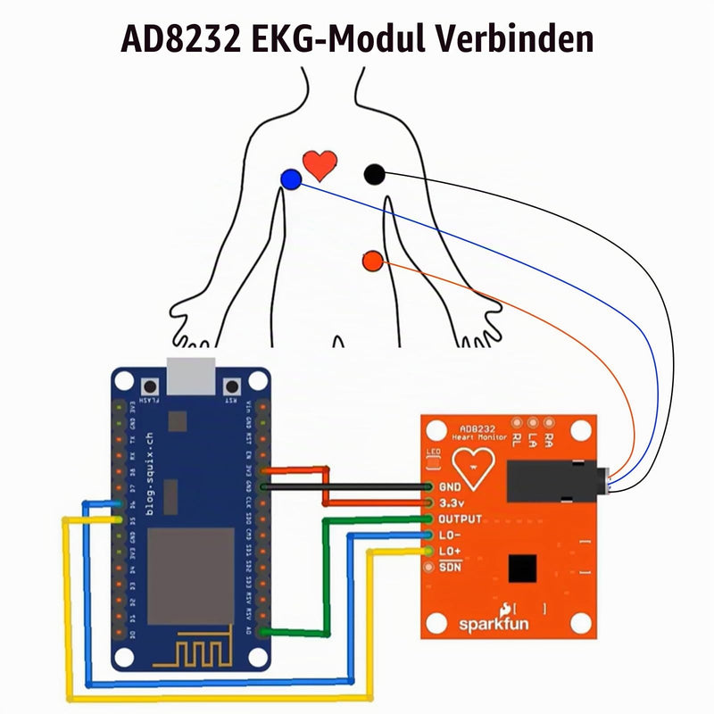 ad8232 ECG Module Kit Binghe AD8232 ECG Measuring Coil Sensor for Heart Rate Monitoring with Dupont Cable Compatible with Arduino