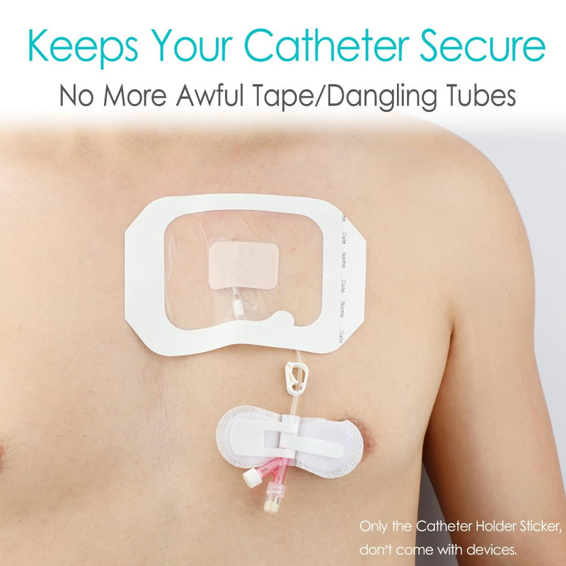 Low-Profile Catheter Stabilization Device for Kids Baby's Gtube Feeding Tube G J Tube Peg Pd Catheter Holder Peritoneal Dialysis Accessories Adhesive Patch Dressing (Pack of 20) Low Profile Tube Holder - 20 Pcs