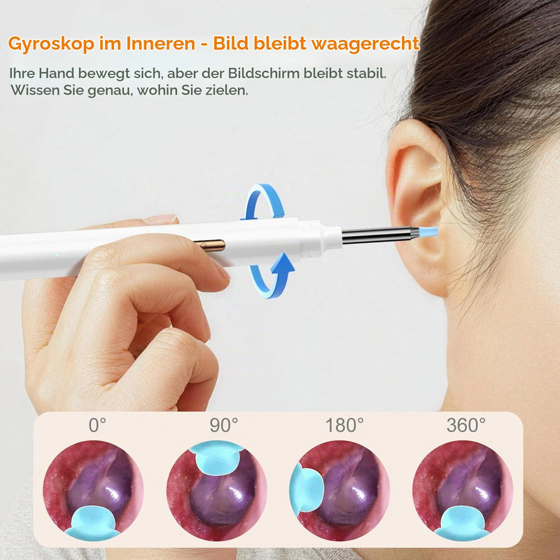 Ear Wax Remover Otoscope with Screen, Ear Cleaner with Otoscope for Home - No Phone, No App, No WiFi, One Button Operation, Wireless Earwax Camera 1080P HD