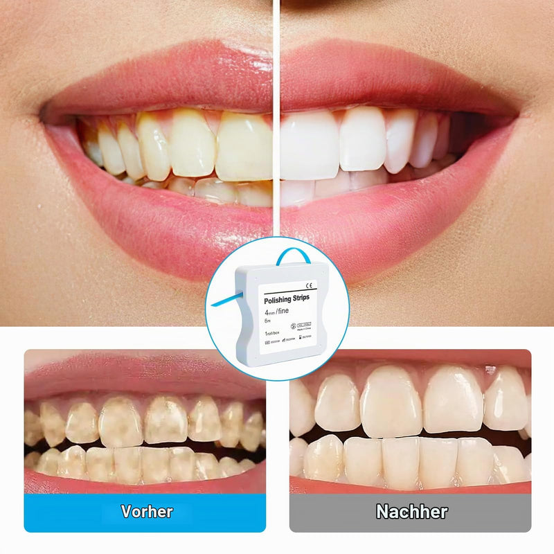 Tooth Sandpaper Dental Polishing Strips Size Rough - 60μm Size of Grains - 4 mm Width - 6 m / Rolls/Box, Resin Tooth Polishing Interdental Sanding Tool (Blue)
