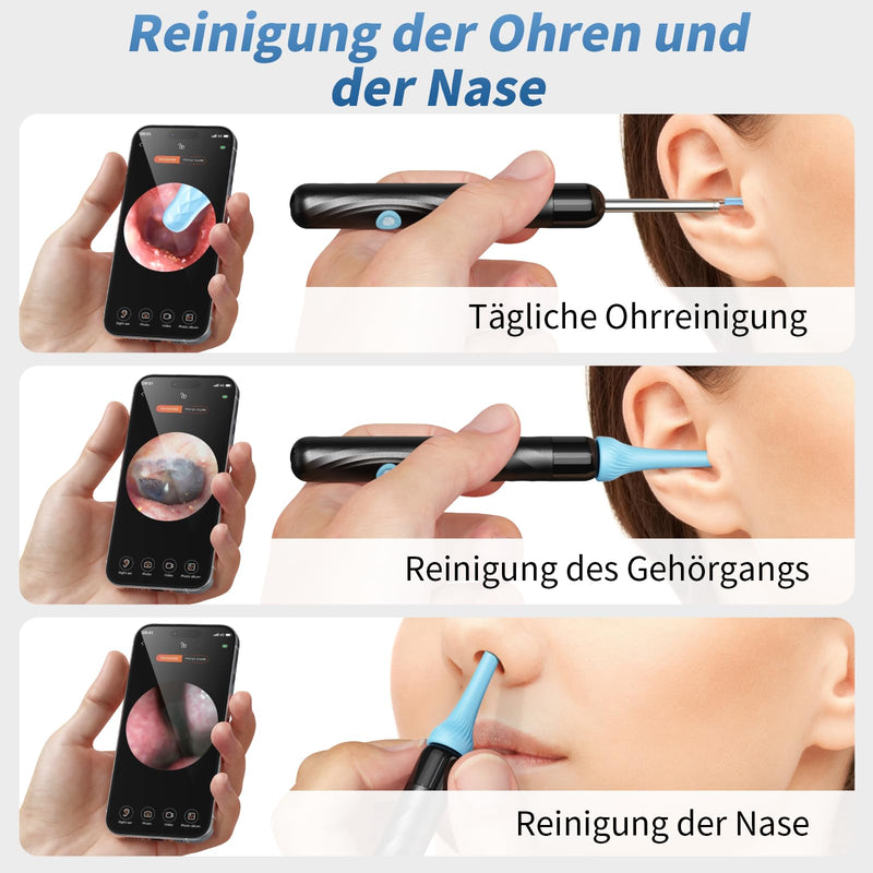 Qimic Visual Ear Cleaner with WiFi, IP67 Waterproof and 360° Wide Angle Camera with 6 LEDs for Adults and Children, Black
