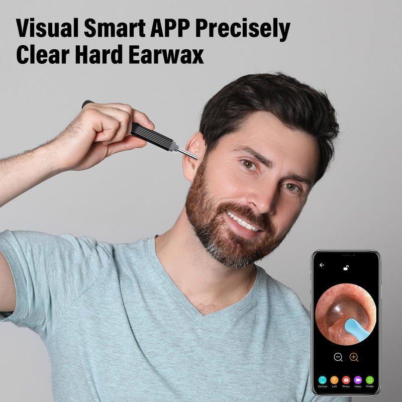 Earwax Remover Otoscope, Morelax 1080P WiFi Ear Cleaner, IP67 Waterproof with 360° Camera, Ear Endoscope with 6 LEDs for iPhone, Android, iPad, Adults, Children and Pets (Black) Black