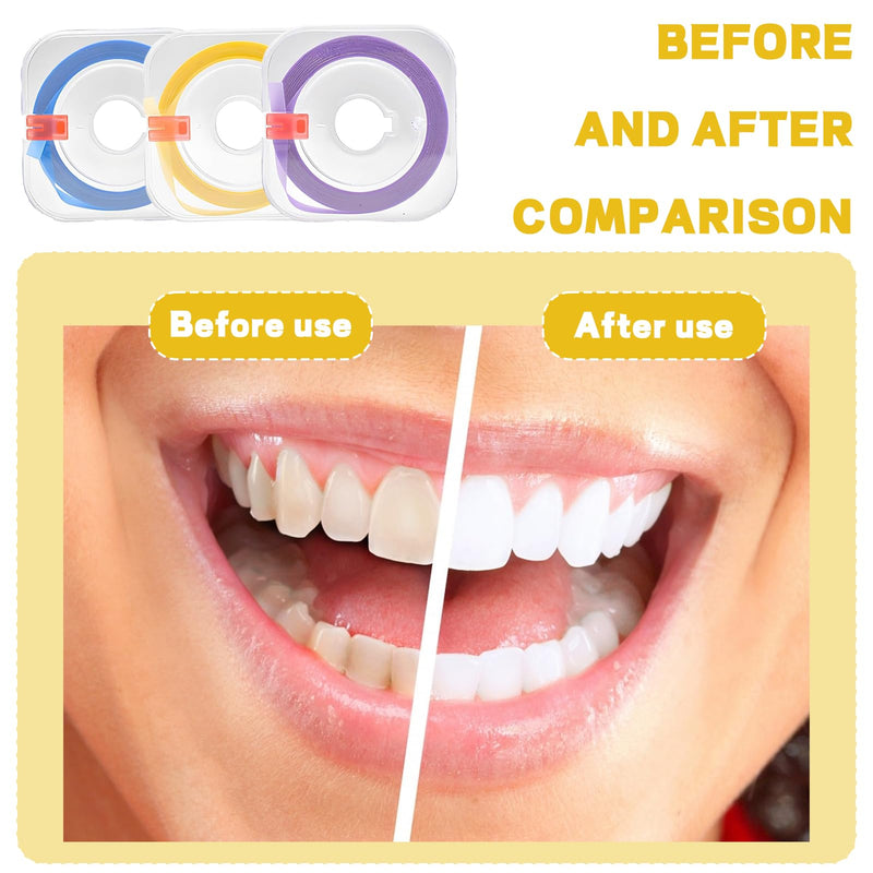 3 for the gap between rolled teeth, tooth sandpaper, coloured tooth sandpaper, dental sandpaper for tight spaces, teeth polishing, interdental space with tooth polish 4 mm x 6 m)