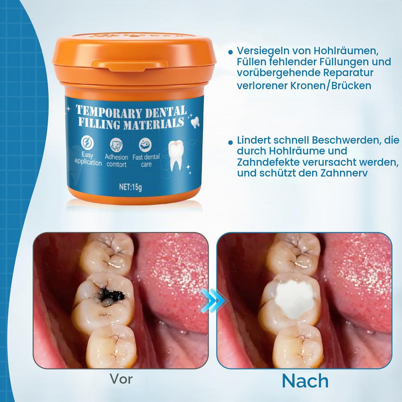 Tooth filling, temporary tooth filling, tooth cement self-hardening, durable, tooth repair kit, temporary tooth filling material for fillings for caries/attachment of coronations - 15 g