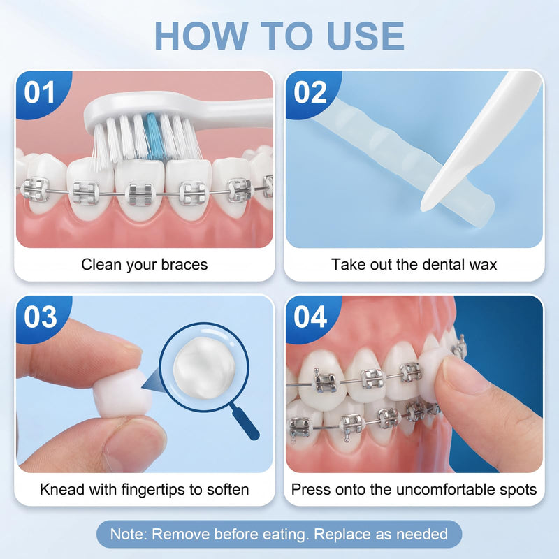 9 Boxes of Braces Wax, Pre-Cutting Wax for Braces, Relieves Irritation and Pain Caused by Friction of Braces (White, Pink, Blue)