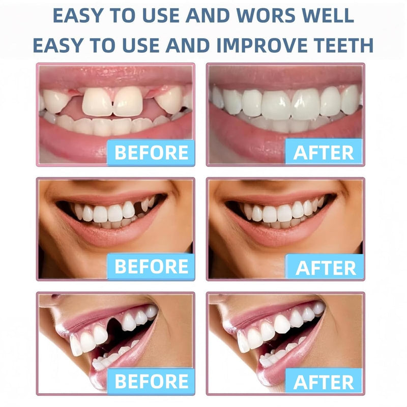 Pack of 2 40G Denture Adhesive, Extra Strong, Adhesive Gel for Dentures, Dentures Adhesive Gel with Safe and Gentle Adhesive Effect, Adhesive Gel Dentures for Firm Bite