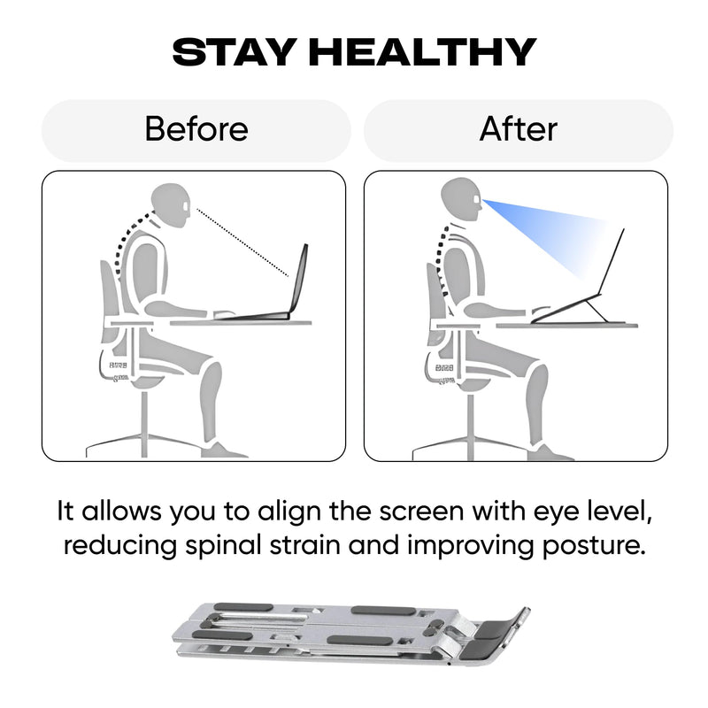 Laptop Stand Adjustable – 7-Level Foldable Aluminum Riser, Portable Laptop Holder for Desk, Compatible with 9-15.6 Inch Laptops, Ergonomic & Sturdy