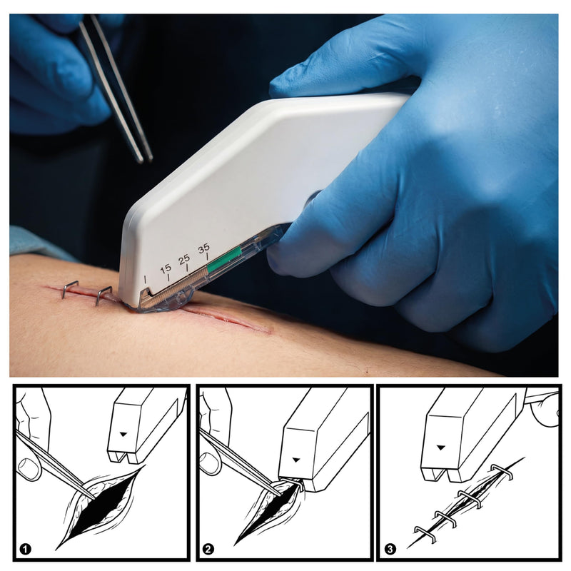 KMINA Skin Stapler F35W with 35 Sterile Staples White (Pack of 5) | Medical wound tacker made of stainless steel with ABS housing, ergonomic design, safe opening, latex-free