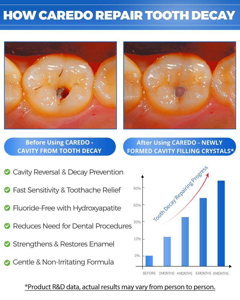 CAREDO Cavity Reversal Hydroxyapatite Toothpaste for Adults, Cavity Tooth Filler as Home Cavity Repair, Fluoride Free Reverse Cavities Treatment for Tooth Decay Repair, Remineralizing Repair 3.52OZ Spearmint 3.52 Ounce (Pack of 1)