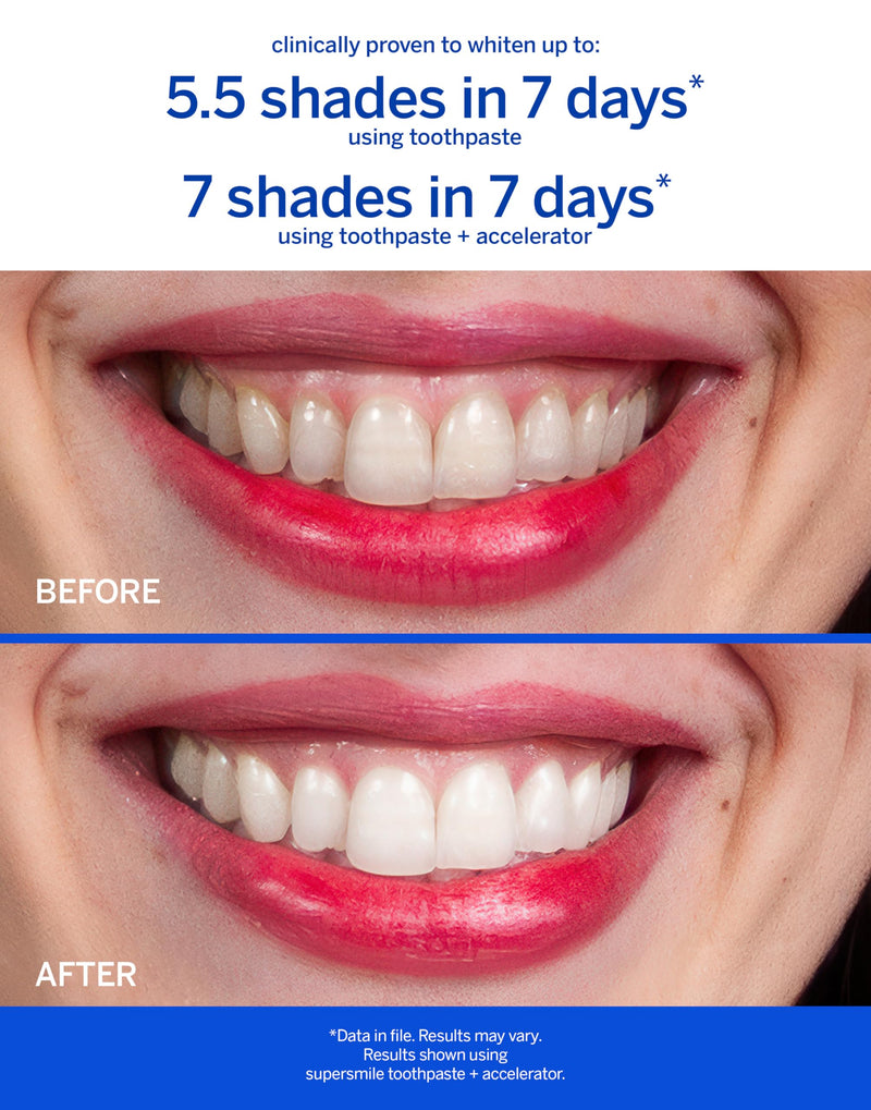 Supersmile Fluoride-Free Whitening System, Original Mint, Sensitivity-Free | 3.4 Oz Toothpaste + 3.6 Oz Accelerator, Whitens 6 Shades in 7 Days, RDA 65 Low Abrasion, Veneer Safe, Calprox® Powered