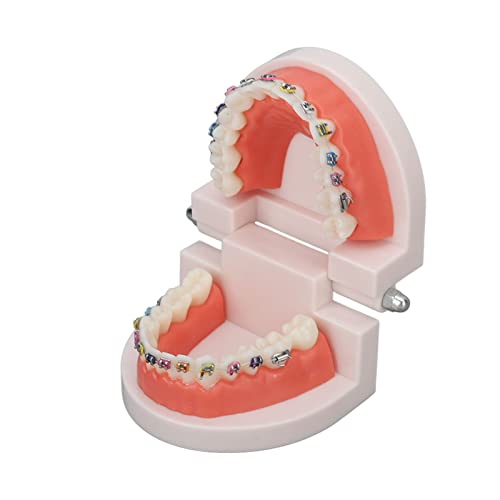 Orthodontic Dental Model, Typodonts Orthodontic Demonstration Model with Metal Wires and Bracket Teaching, Learning, Interpretation Model for Adults and Children