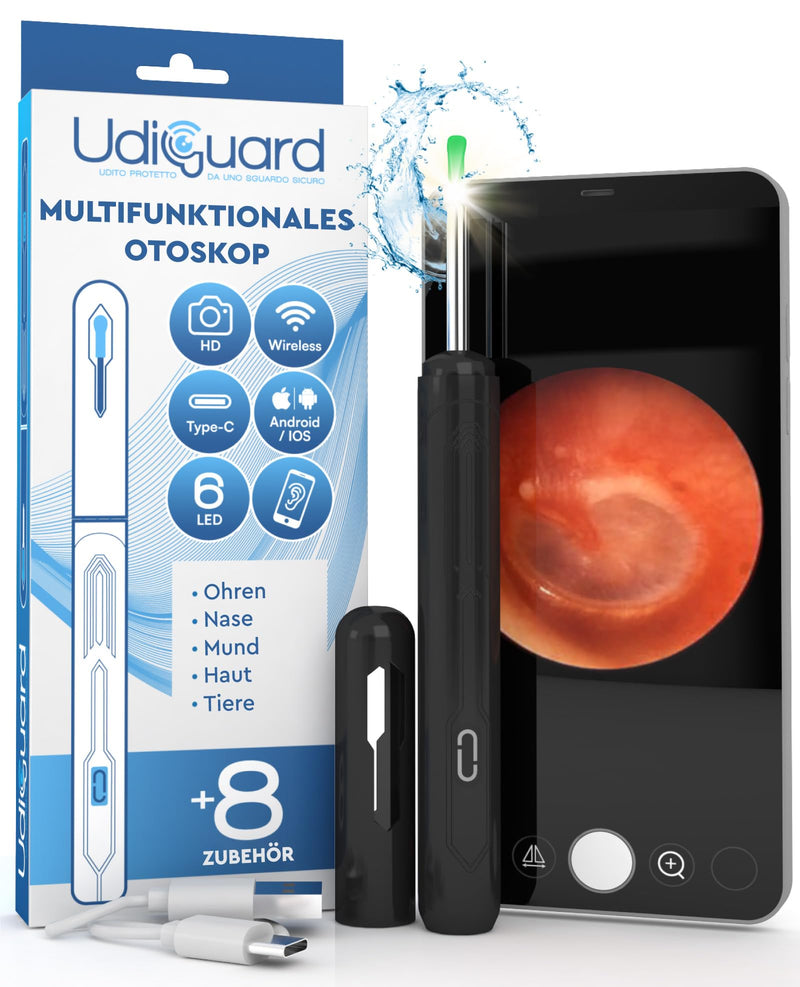 Ear Wax Remover Otoscope with Camera 1920p 3.6 mm WiFi Ear Cleaner - UdiGuard Ear Mirror Ear with 6 LED Lights Dogs Adults and Children - Compatible with iPhone iPad Android Black Udiguard Black Otoscope
