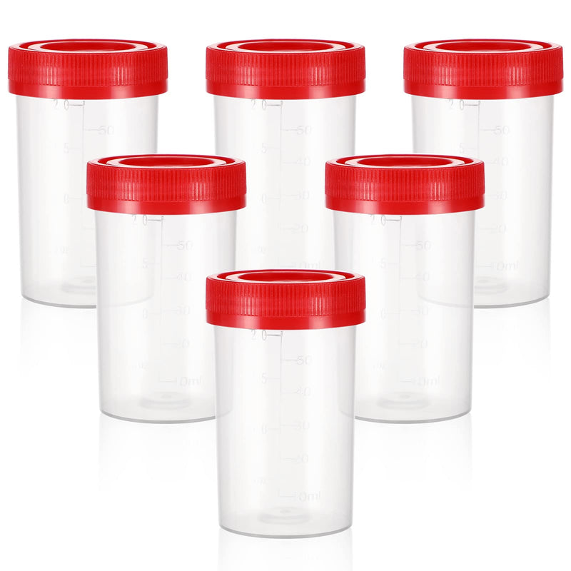 iplusmile Pack of 10 urine cups sample cups with lids 60 ml urine sample cups urine tubes urine cups ovulation test cups sample tubes for pregnancy test laboratory random color