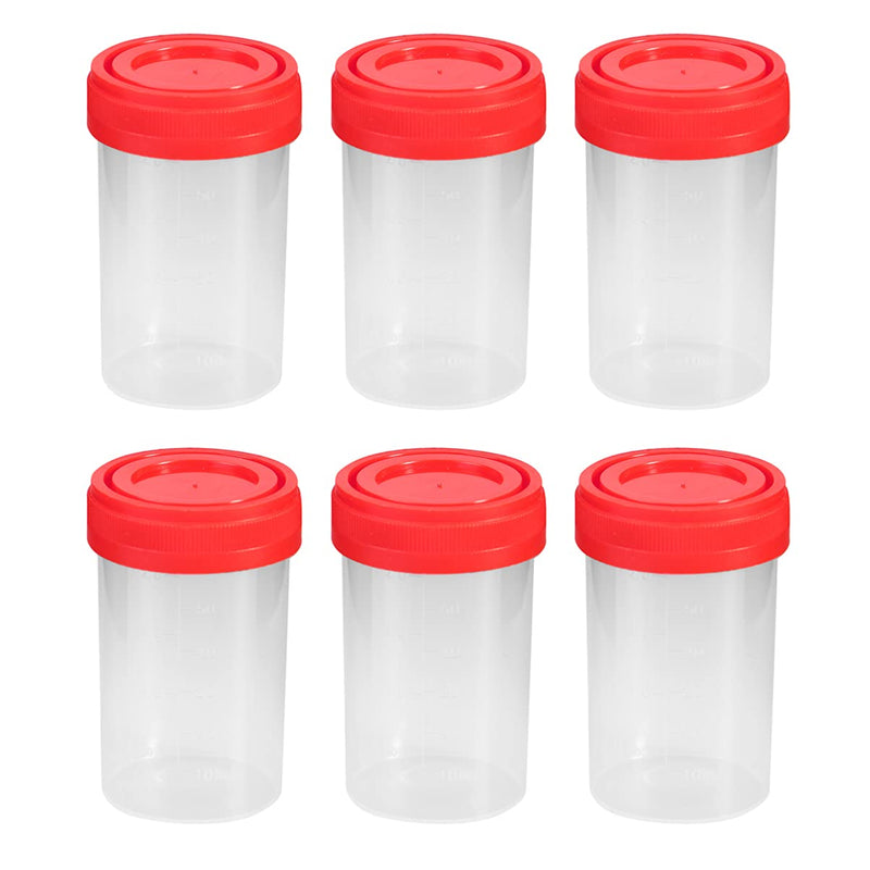 POPETPOP Sample containers 20 pieces sample cups with lids 60 ml urine container urine sample collection cup test cup without laboratory (random color) urine cup with screw lid medium as shown