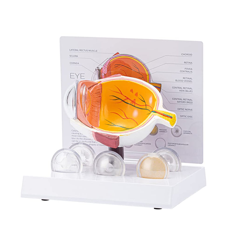 Cornea Eyeball Model Human Eye Model Human Eye Demonstration Teaching Prop Cataract Anatomy Medical Teaching Model