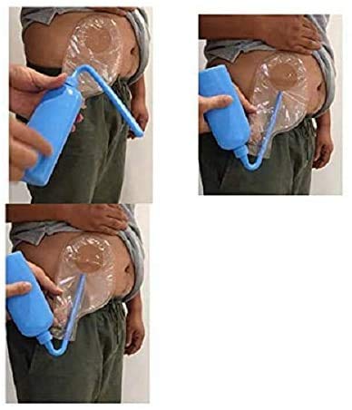 Colostomy Bag Cleaning Tool - Stoma Bag Washing Bottle Rinse Pot for All Ostomy Bags - Reusable Wash Bottle (1PCS PZ) 1 Count (Pack of 1)