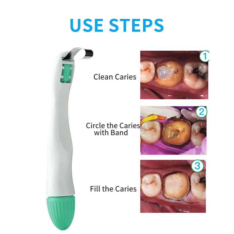 Dental Matrix Band, 50pcs Momar Restoration Matrix-Profecto Sectional Matrix Ring System Adjust (6MM-Curved) 6MM-Curved