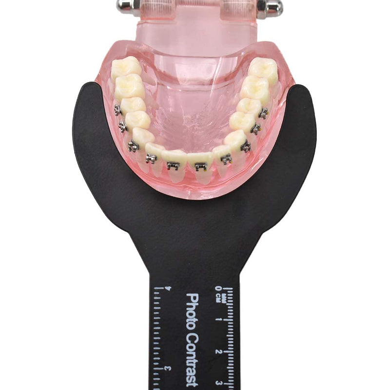 MIBICIRI 6 Pcs Dental Intraoral Photography Black Background Plate Dental Photo Contrast Image Contraster Kit Dental Tool