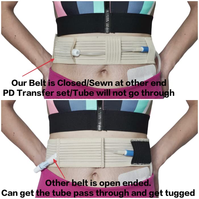Peritoneal Dialysis Breathable PD Catheter Belt | Secure Peg Tube Feeding Holder | Supplies for PD Dialysis Men and Women Small Beige