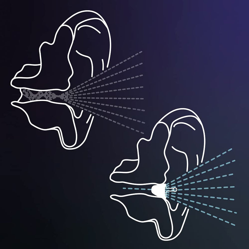 Flare Audio® Calmer® Night Mini White – in Ear Device to Gently Soothe Sound sensitivities - Reduce Stress in The Evening and Whilst Sleeping