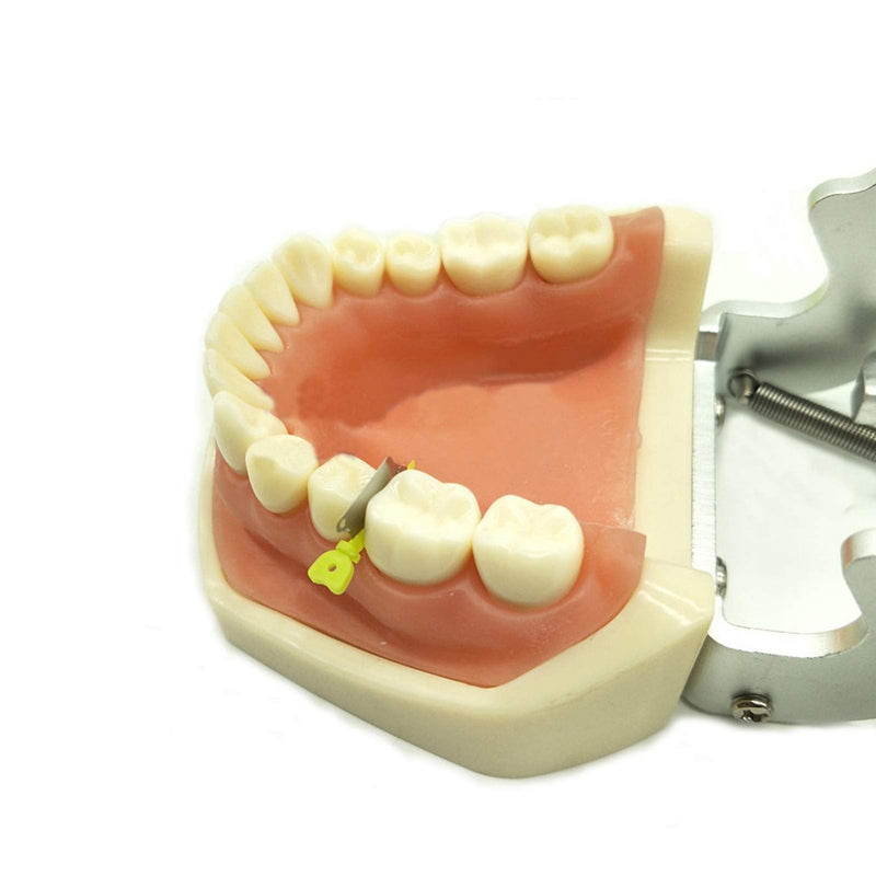 Angzhili Dental Interproximal Plastic Wedge(40 Pcs/Box) (Green) Green