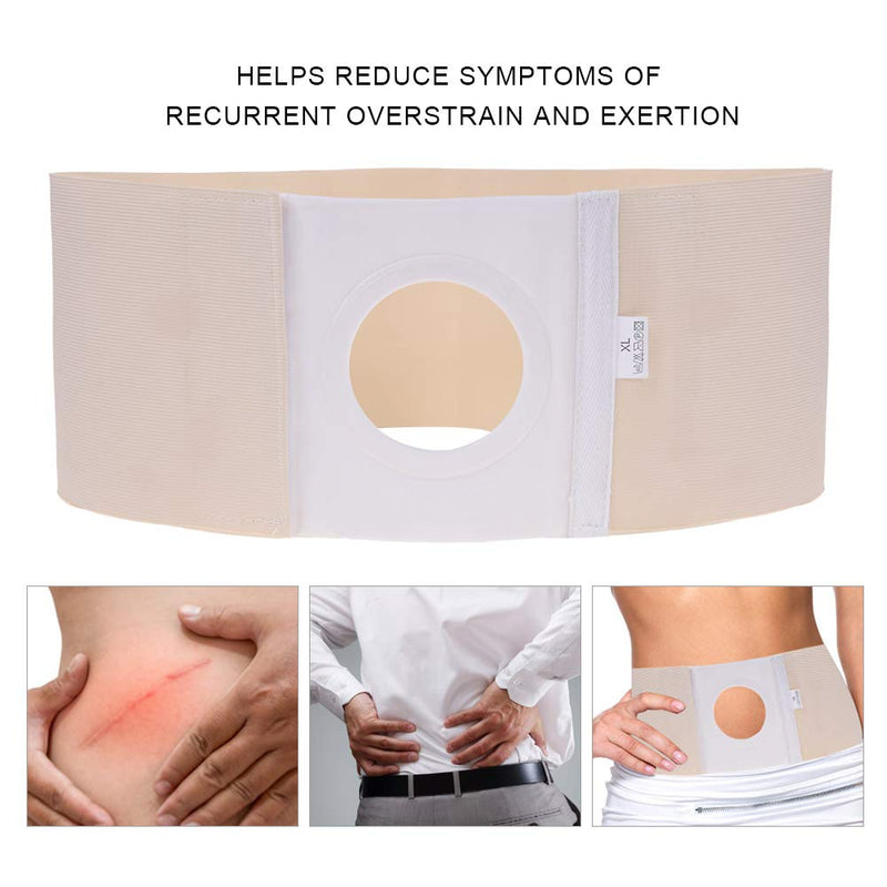 Salmue Ostomy Hernia Belt, Elastic Ostomy Hernia Belt for Colostomy Bag Abdominal Binder with Stoma Opening Navel Hernia Support, Help Relieve Pain for Incisional, Epigastric, Ventral, In XL