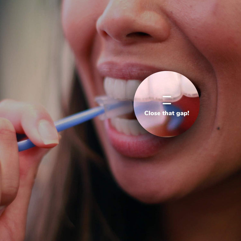 PUL 2 in 1 Chewies & Clear Aligner Removal Tool Combo by The Pultool | Compatible with Invisalign Removable Braces & Trays, Aligners, Retainers, & Dentures | Hygienic, Durable, Compact