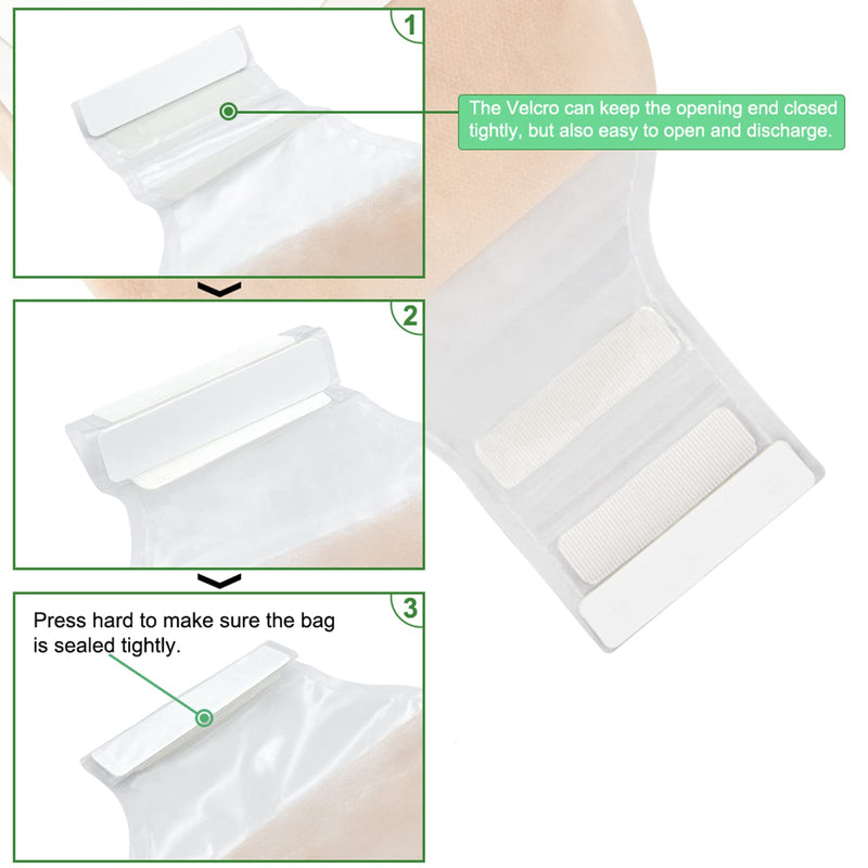 KONWEDA 20PCS Ostomy Bags,Colostomy Supplies,Two Piece Drainable Ostomy Pouch for Ileostomy Stoma Care, Cut-to-Fit (15pcs Bags+5pcs Barrier)