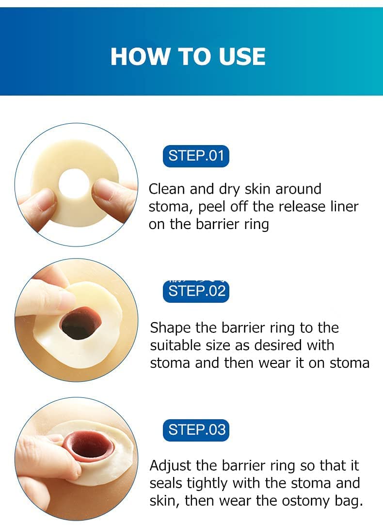 KONWEDA Ostomy Barrier Rings-Outer Diameter: 2" (48mm) 4mm Thickness - Box of 10