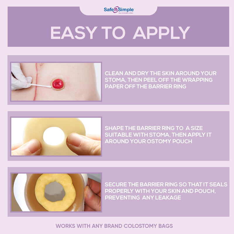 Safe n' Simple Conforming Adhesive Seals, 2 Inch (Pack of 10)